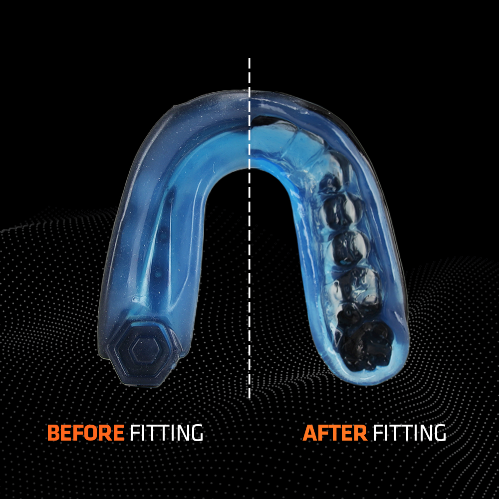 SHOCK DOCTOR - Mouthguard Gel Max (Blue / Black) - 6100BB