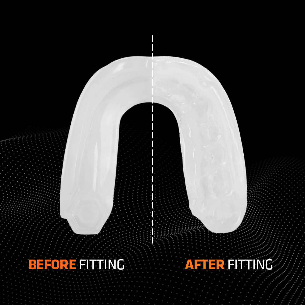 SHOCK DOCTOR - Mouthguard Gel Max (TransClear) - 6190TC AD