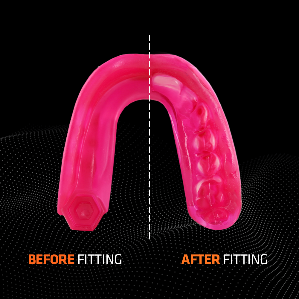 SHOCK DOCTOR - Mouthguard Gel Max HOT PINK - 6200PK