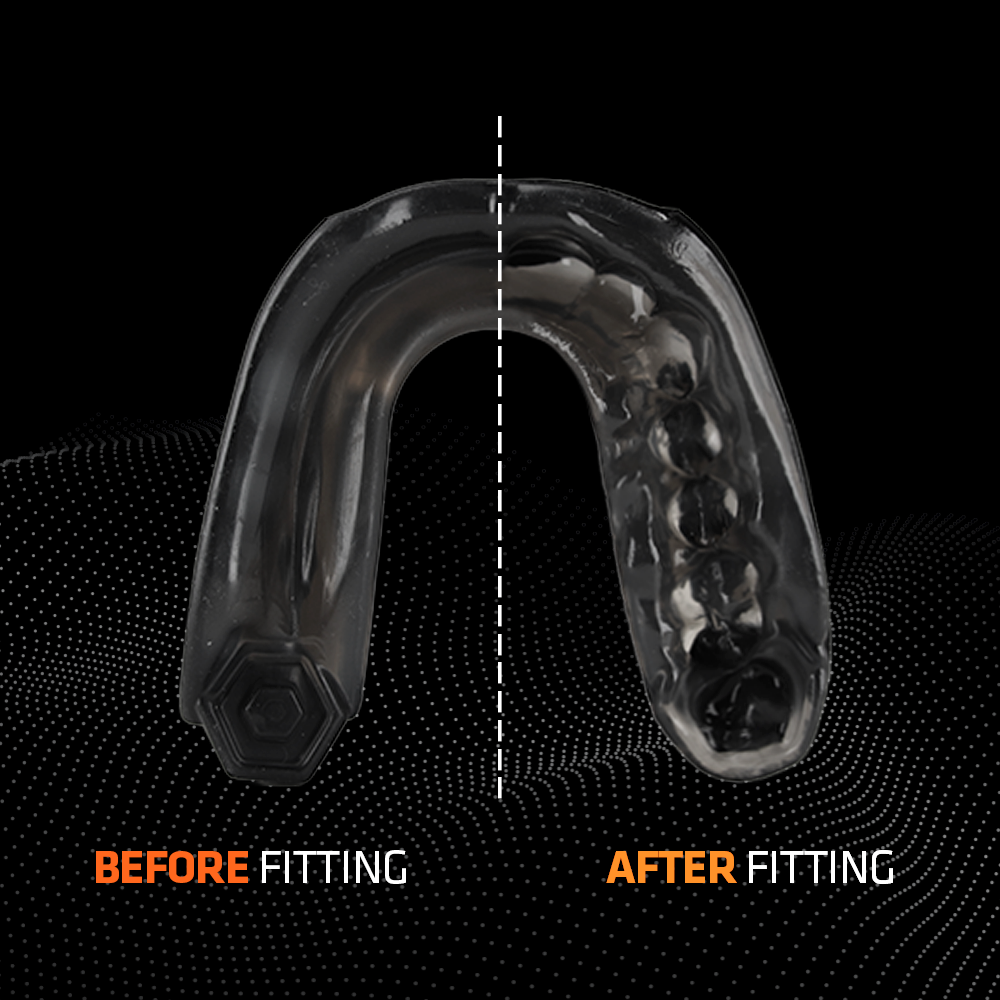 SHOCK DOCTOR - Mouthguard Gel Max (Black) - 6210BK AD
