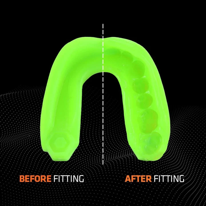 SHOCK DOCTOR - Mouthguard Gel Max (Fluro Green) - 6100-FGN