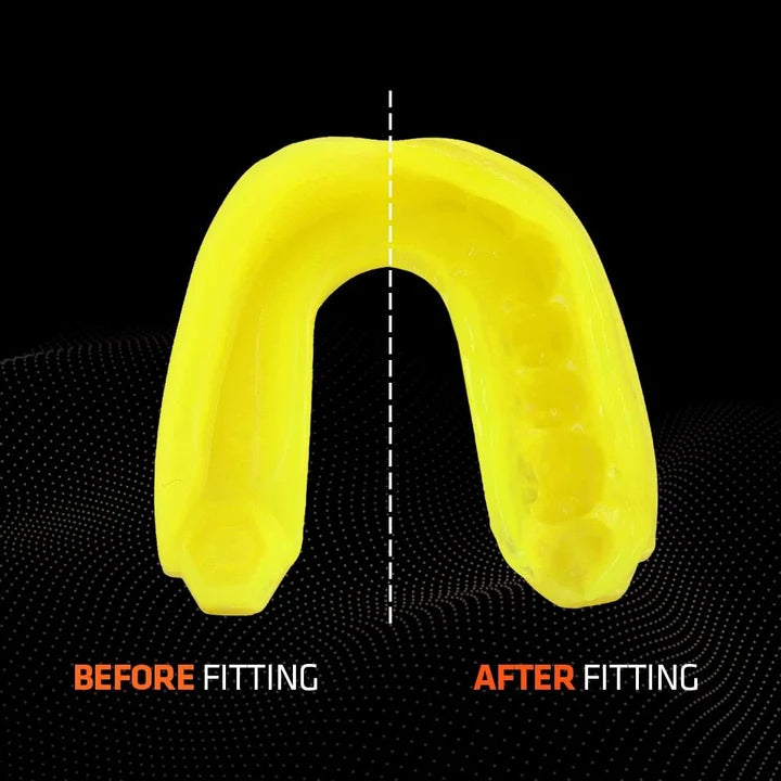 SHOCK DOCTOR - Mouthguard Gel Max (Fluro Yellow) - 6100-FYL
